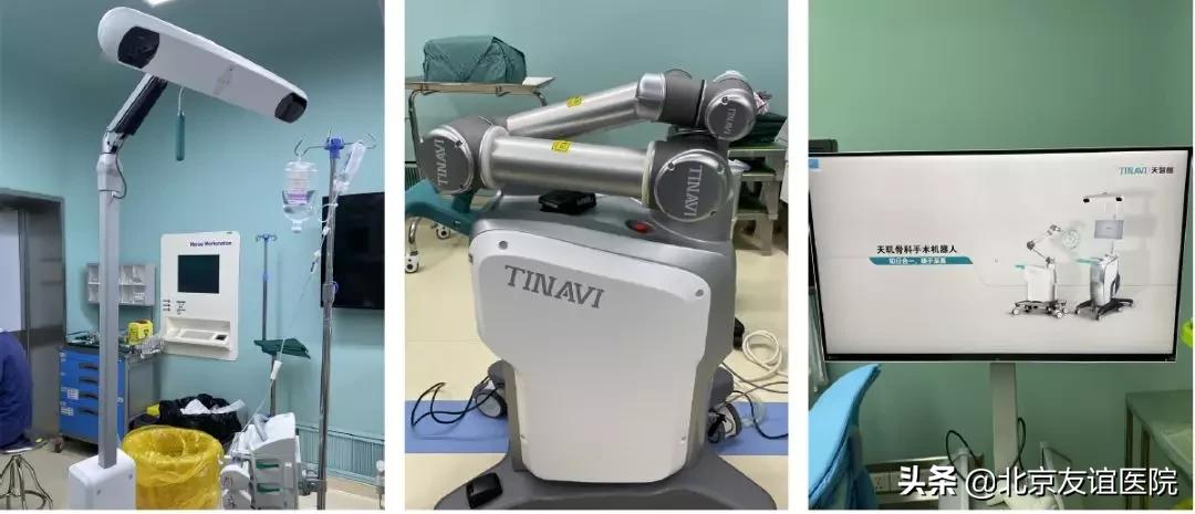 北京友谊医院做甲状腺微创手术,北京友谊医院手术