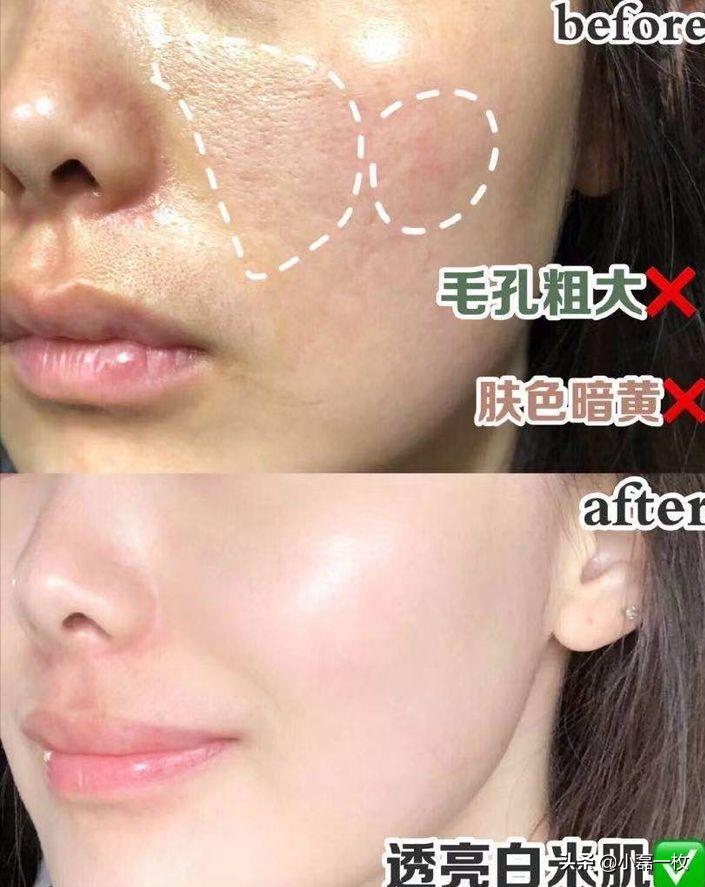 熬夜脸色蜡黄怎么改善最快最有效,脸熬夜蜡黄暗沉怎么调理