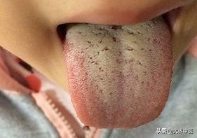 宝宝舌头能反映什么病,看孩子的舌头知道身体状况