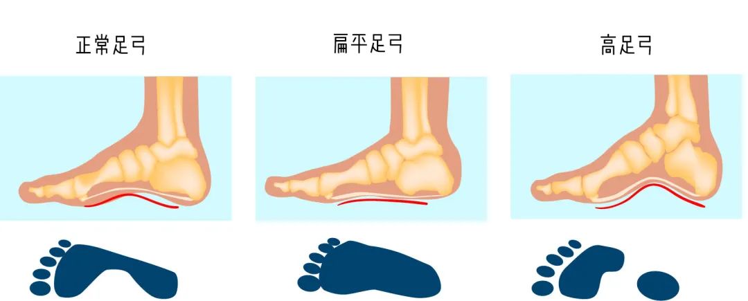 怎么穿尖头高跟鞋不磨脚,新高跟鞋后跟磨脚小妙招