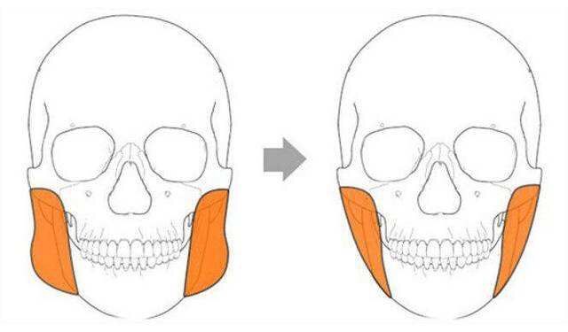 脸宽怎么改善脸型,脸小怎么办教你一招变大