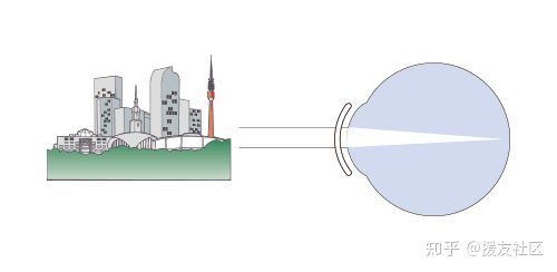 美尼康rgp角膜塑形镜好吗,尼康rgp硬性隐形眼镜