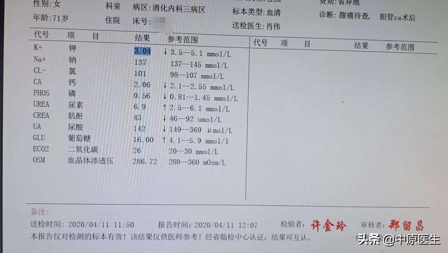 团队工作：老太太患黄疸规范治疗后仍高烧，转到介入科很快治好了