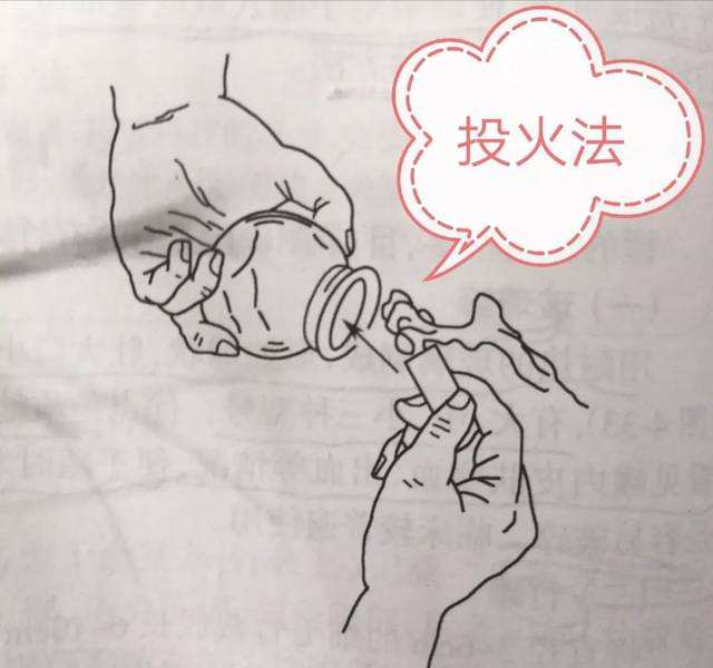 拔罐竟然把自己门牙弄断，基本操作要弄清楚