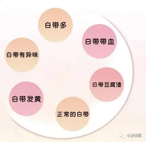 女性白带的危险信号,白带是精子形成的吗