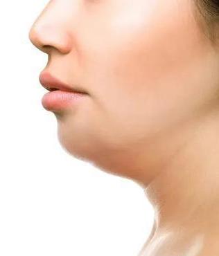 天生没有下颚线怎么练,天生没有下颌角怎么抗衰