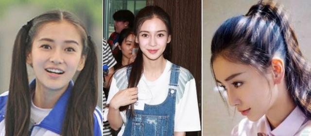 秃头大夫教你让头发浓密且多,秃头少女该如何挽救头发