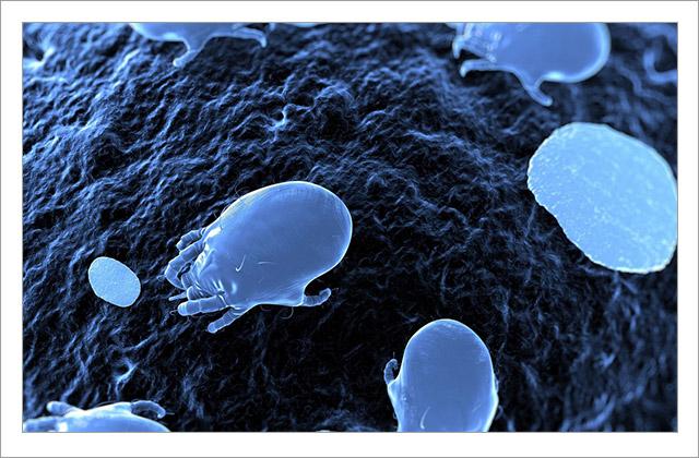 脸上螨虫的正确消灭方法,脸上的螨虫能不能彻底消灭