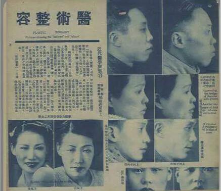 民国才女林徽因割双眼皮,林徽因假才女