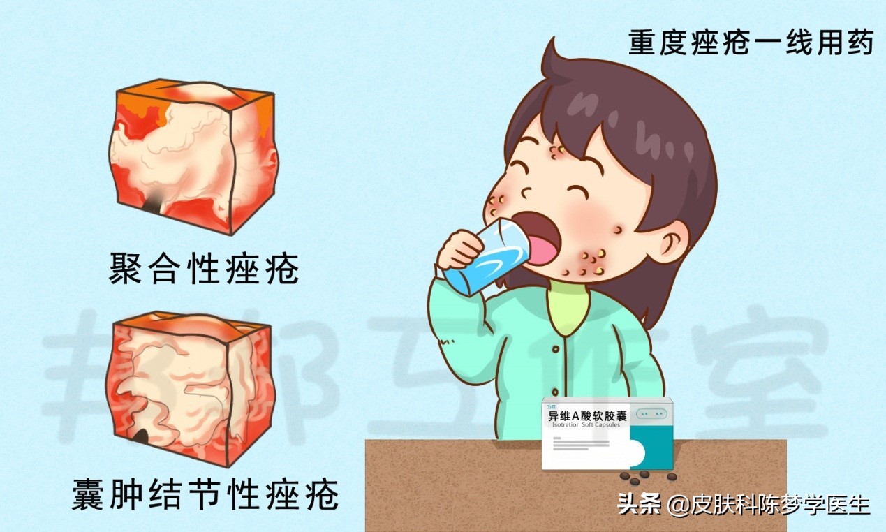 脸上爆发了严重的青春痘，这4种药物是首选