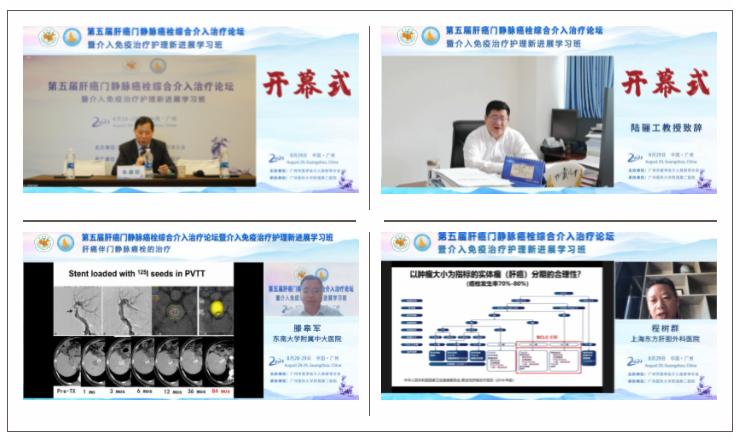 肝癌门静脉癌栓做介入效果怎样,2019肝癌介入论坛