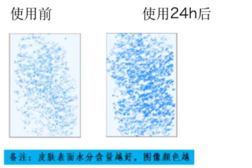 修复受损肌肤屏障水光,修复肌肤微生物屏障