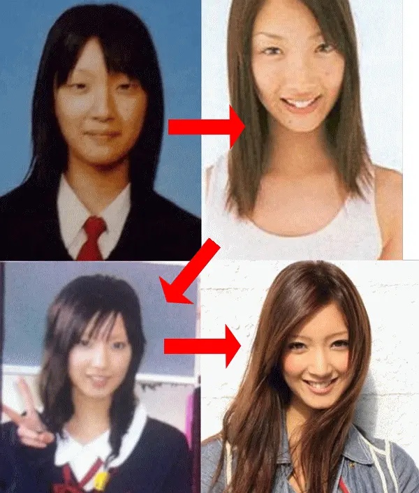 日本整容惊人案例,日本整容是不是最先进