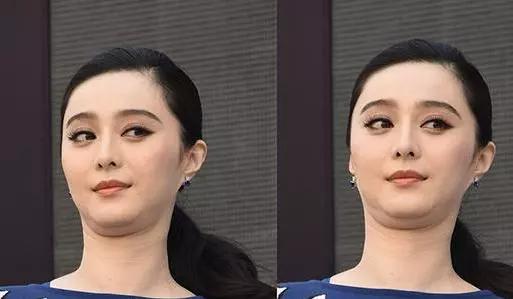 有没有解决双下巴的小物件,双下巴的福音来了