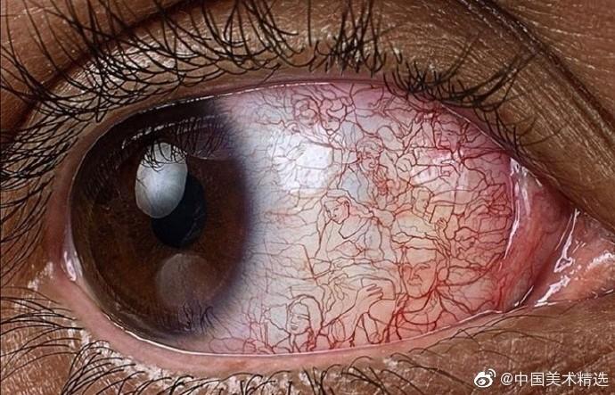 眼睛布满血丝通红是什么原因,眼睛胀红眼球有血丝是什么问题