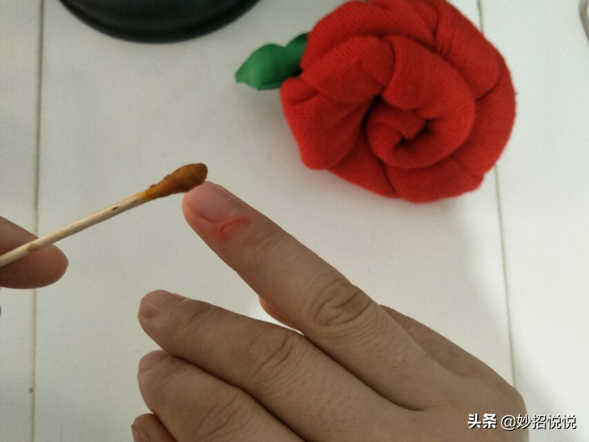 不知道被什么划伤的伤口怎么处理,被划破如何快速愈合