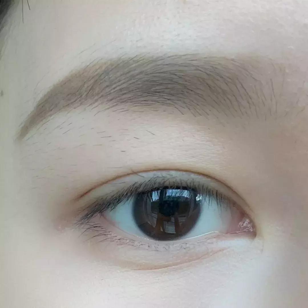 去割双眼皮,去韩国割双眼皮科学不