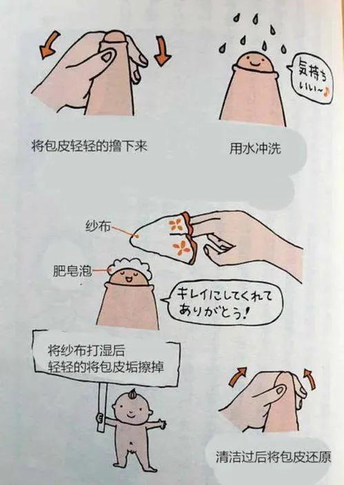 包皮垢该怎么清理,包皮垢很严重怎么清理干净