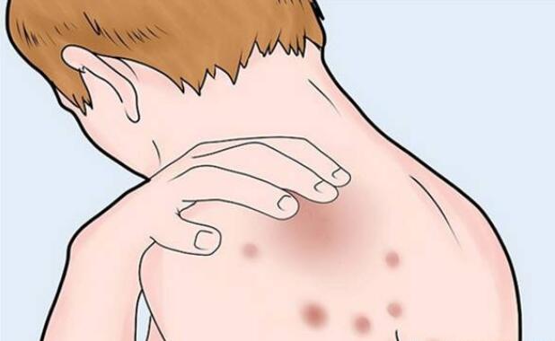 洗澡的时候搓下来的黑泥放大100倍,搓澡下来的黑泥是什么显微镜