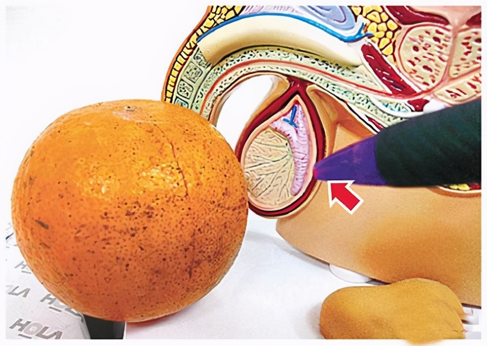 睾丸炎精索静脉曲张治疗,男34睾丸静脉曲张要手术吗