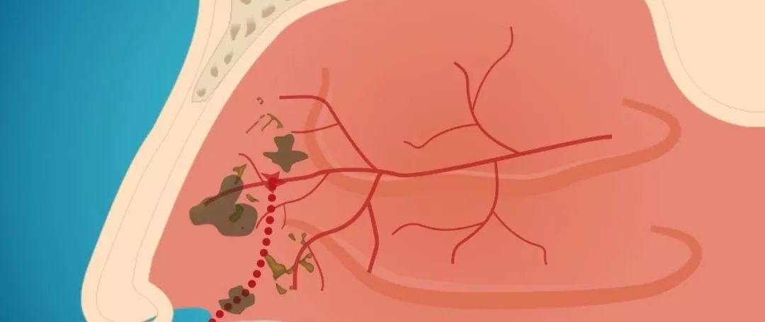 人为啥喜欢挖鼻屎,为什么我们爱抠鼻屎