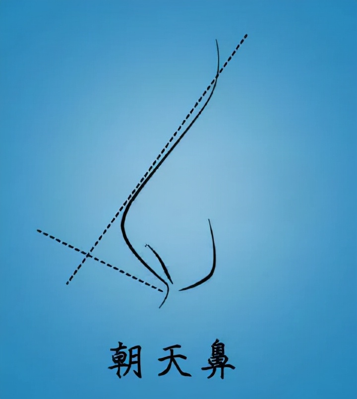 怎么日常改变鼻型,鼻型不好看怎么调整