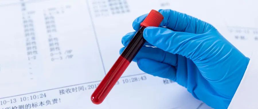 超敏c反应蛋白高服用什么药,超敏c反应蛋白29什么概念