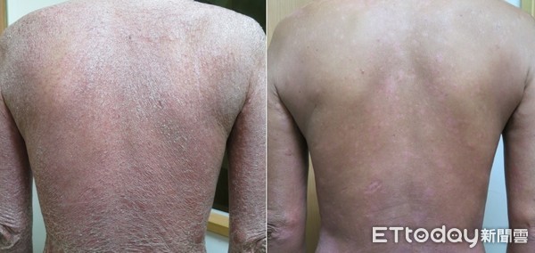 手癣和灰指甲去什么科看,灰指甲足癣看什么科