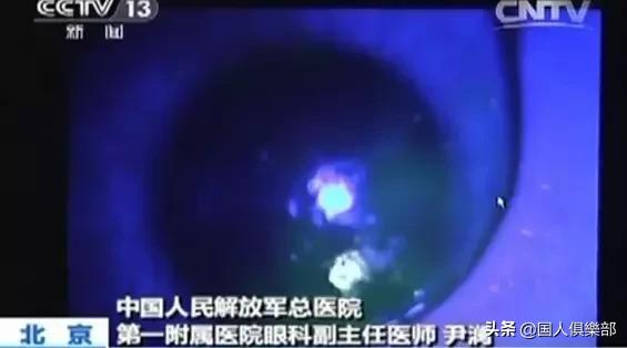 美瞳毁了一个女孩是真的吗,正在被美瞳毁掉的女孩们