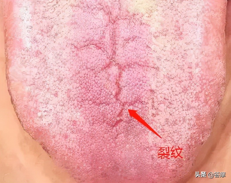 舌象脏腑图,体内有湿寒的舌象