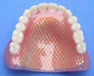 镶牙以后牙齿为什么会松,镶牙过后又烂了