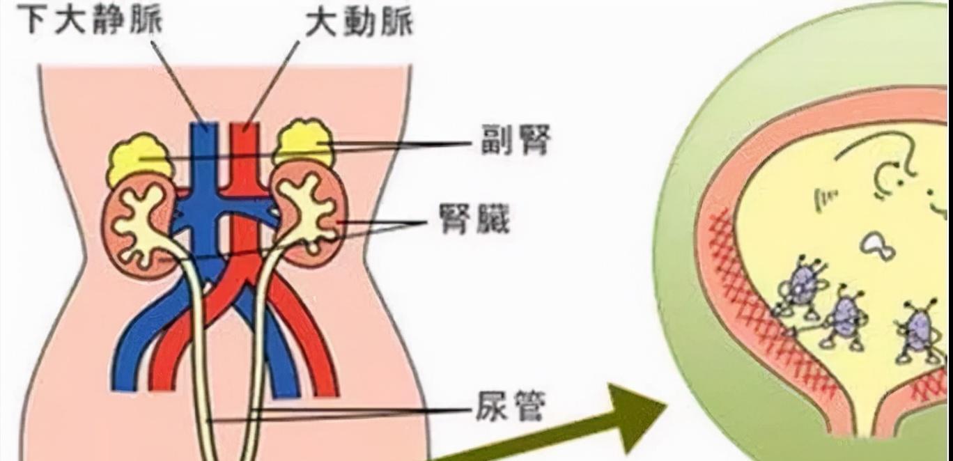 尿急是什么意思严重吗,尿急是什么意思流行用语