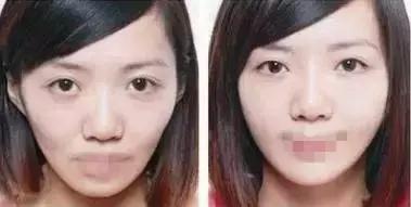 你知道什么是玻尿酸吗,如何快速了解玻尿酸品类