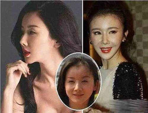那些削骨的女明星怎么样了,哪些明星承认削骨了