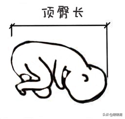 双顶径头围腹围对照表胎儿体重,如何判断胎儿股骨长短