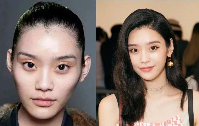 15天暴瘦20斤,却意外暴露了她填充过度的馒头脸