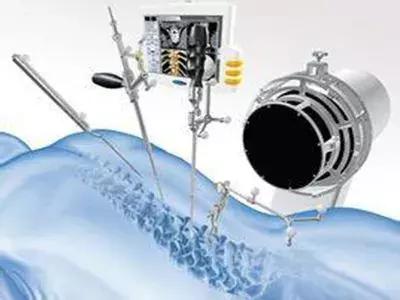 脊柱结核是怎么回事,健康科普不该被忽视的脊柱结核