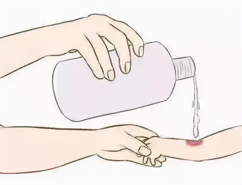 不小心被鲨鱼咬伤了该怎么办,潜水时被鲨鱼咬伤