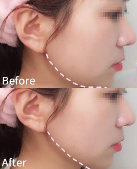 不老女神明星李英爱,51岁李英爱冻龄神颜的原因