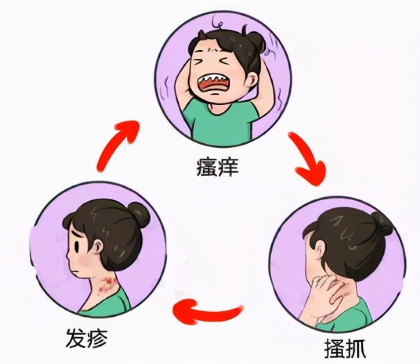 皮炎湿疹瘙痒跟肺有关系吗,皮肤痒各种皮炎湿疹