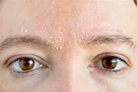 秋冬季节皮肤瘙痒怎么治好,洗脸巾干擦脸部后很瘙痒怎么办