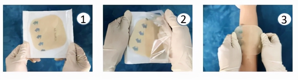 长期躺着的病人怎么预防屁股褥疮,如何预防褥疮的发生和护理措施