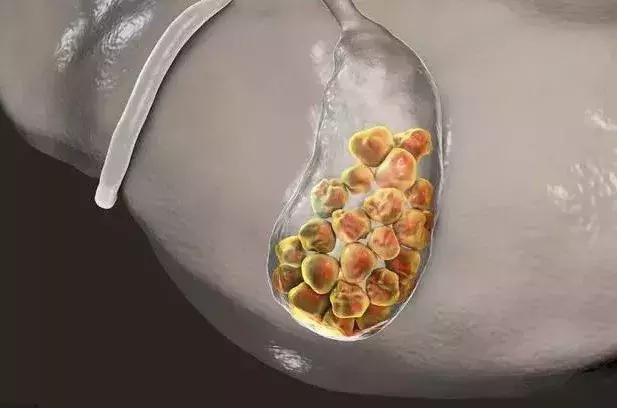 超声检查和b超检查哪个准确,超声b超能检查出什么