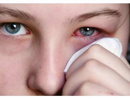 儿童结膜炎一般要多久能症状减轻,结膜炎症状减轻又严重了怎么回事