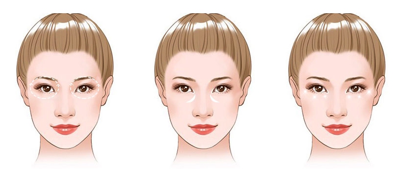 去熬夜型黑眼圈,去黑眼圈眼袋熬夜党福音