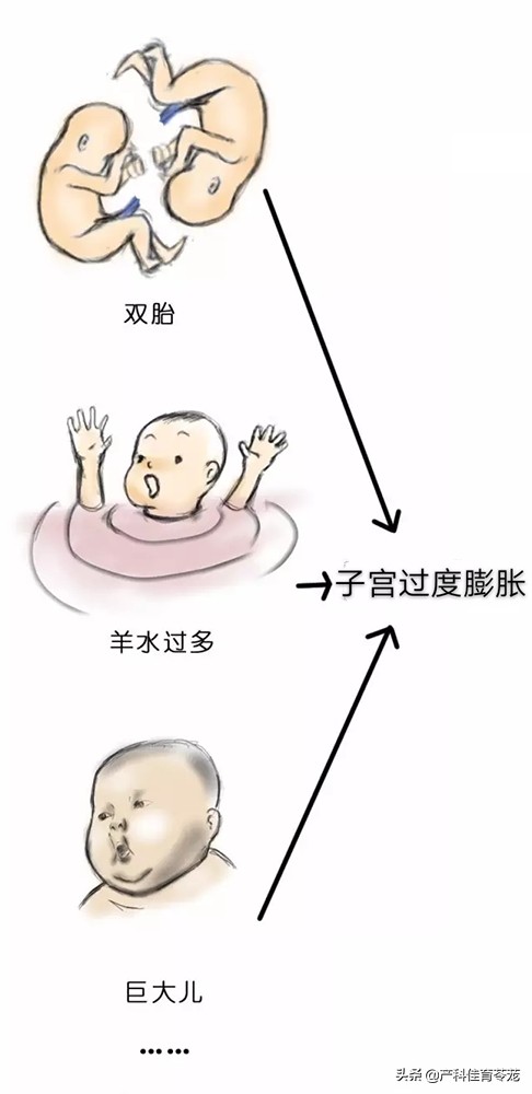 产科医生第几集吐血死了,产科医生致人死亡