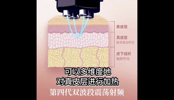 tripollarstop美容仪真假测评,tripollarstopeye测评