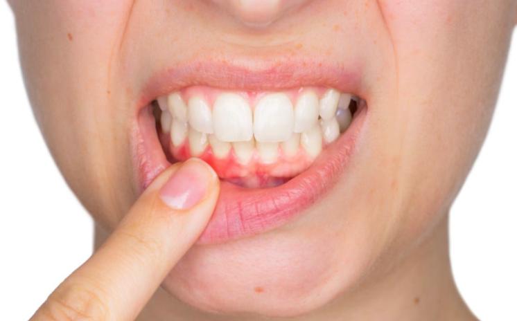 43岁牙齿松动是拔还是让自己掉,80岁老人牙齿松动要拔牙和镶牙吗