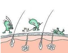 小孩脚背出湿疹怎么治疗,孩子脚面长湿疹是怎么回事