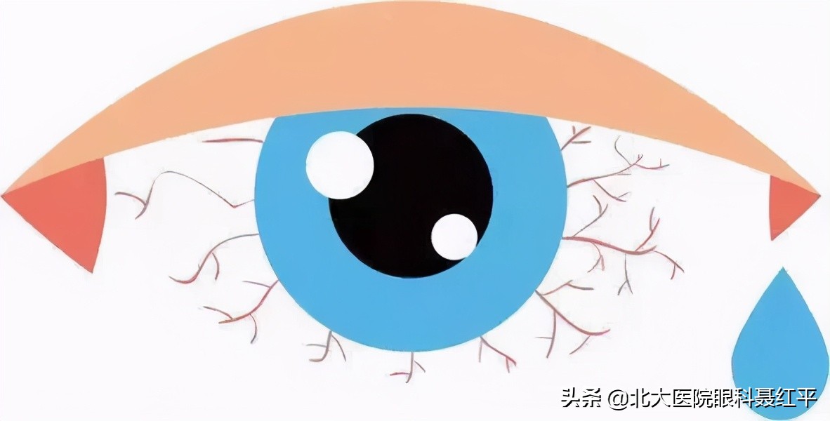 眼睛干涩怎么办如何解决,嘴苦眼睛干涩是什么病因导致的